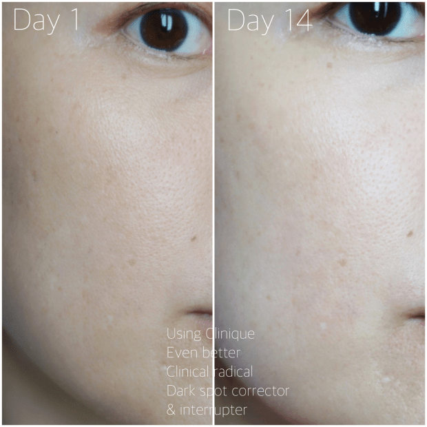 รีวิว Clinique Even Better Clinical Radical Dark Spot Corrector + Interrupter